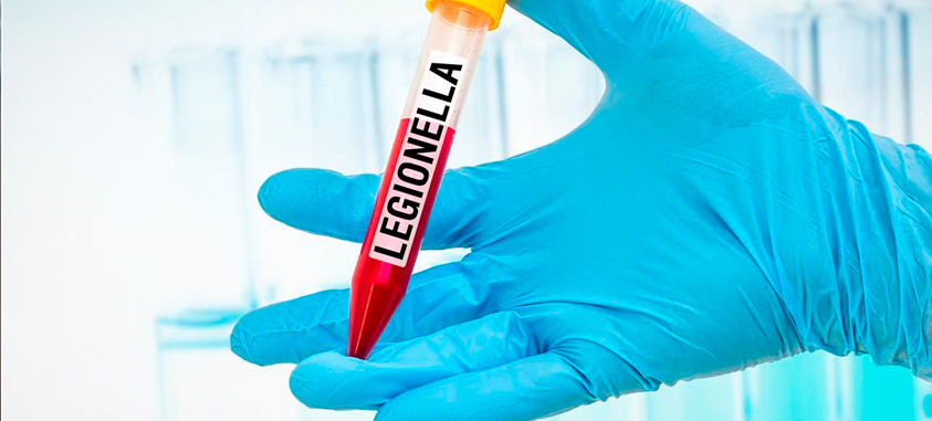 infección por Legionella