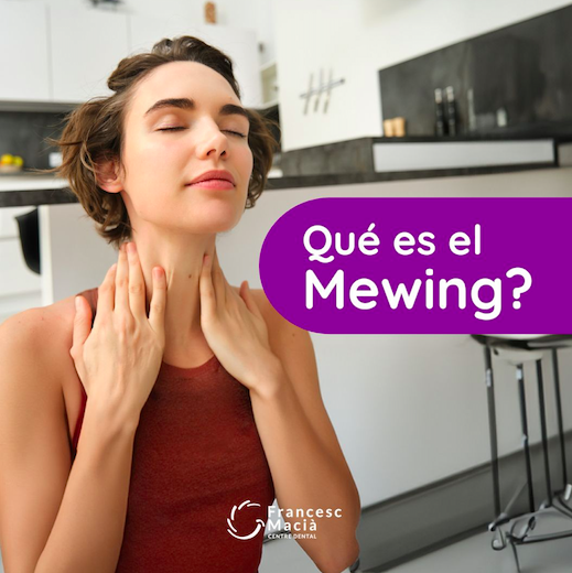 El Centre Dental Francesc Macià explica los secretos del movimiento Mewing