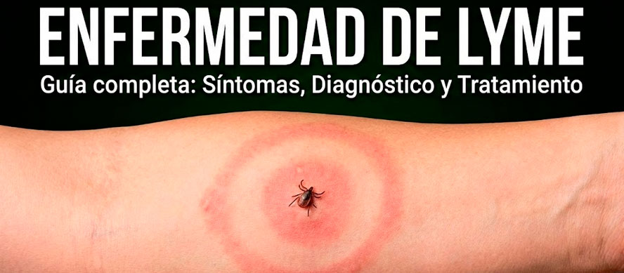 enfermedad de Lyme enfermedad de Lyme